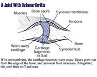 GCS-Illustration B