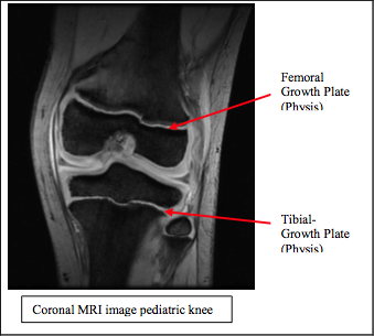 PACL-Illustration B